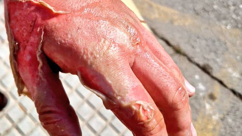 Incendio en Tomares: el error doméstico que reaviva la importancia de la prevención contra incendios